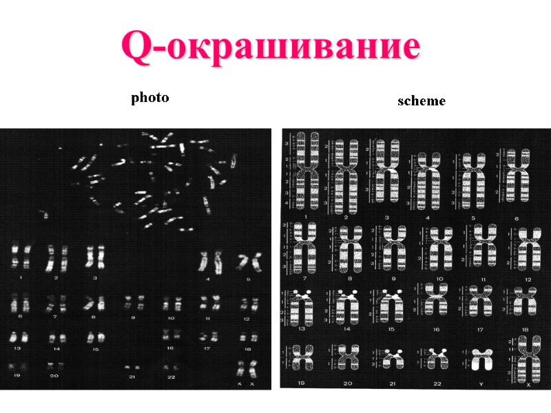 Q-окрашивание  photo   scheme